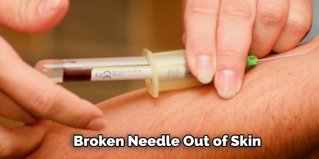 Broken Needle Out of Skin