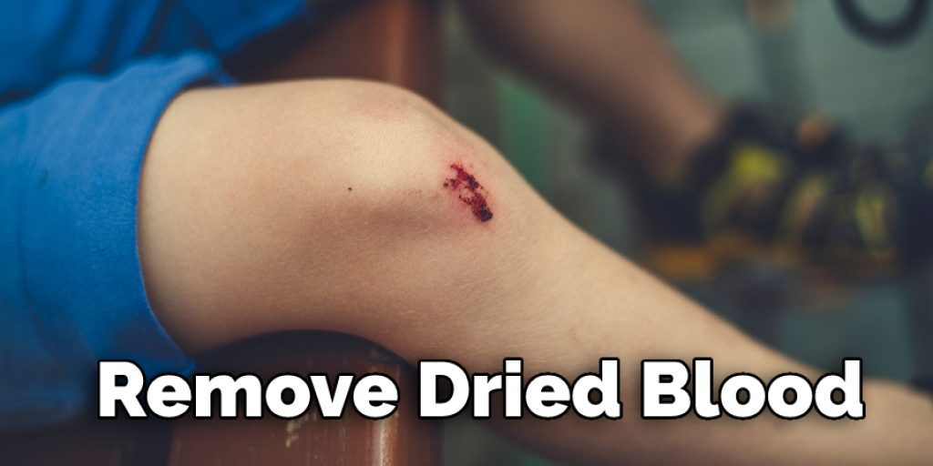 How To Get Dried Blood From Under Skin Detailed Guide