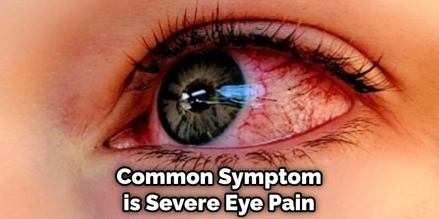 Common Symptom is Severe Eye Pain