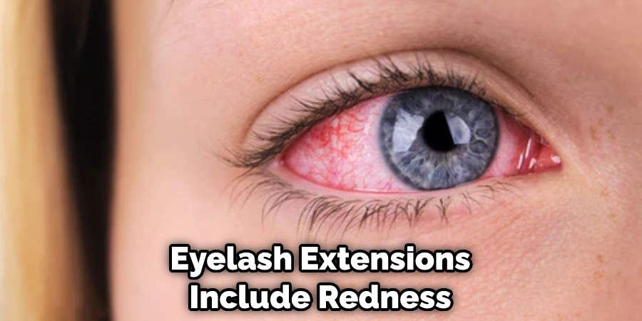 Eyelash Extensions Include Redness