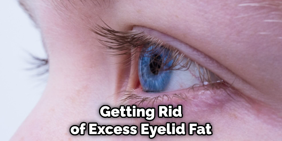 Getting Rid of Excess Eyelid Fat