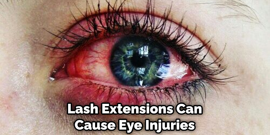 Lash Extensions Can Cause Eye Injuries