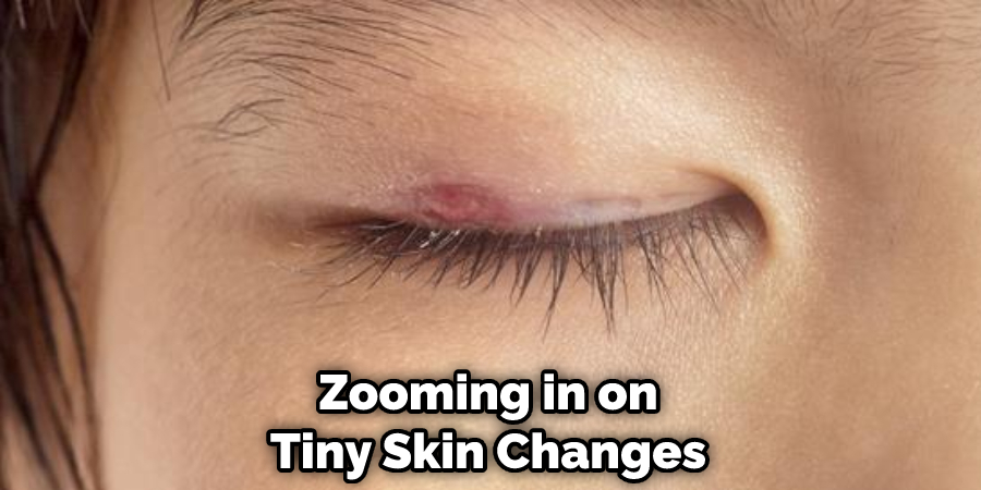 Zooming in on Tiny Skin Changes