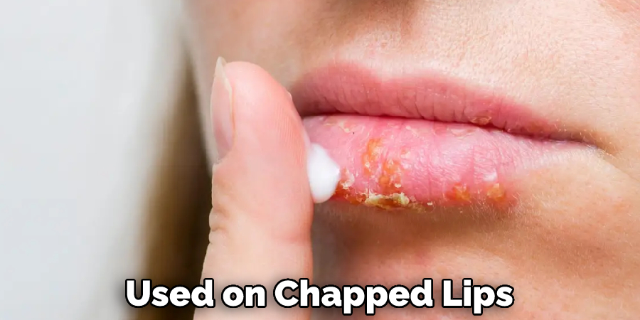 Used on Chapped Lips