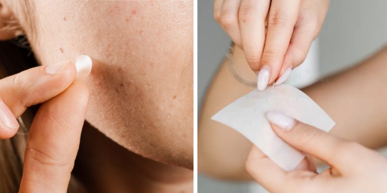 How to Make a Pimple Patch at Home | 10 Easy Steps (2026)