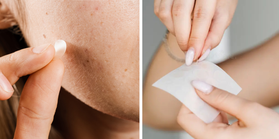 How to Make a Pimple Patch at Home