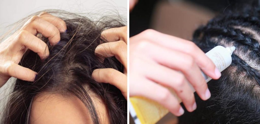 How to Treat Itchy Scalp With Extensions