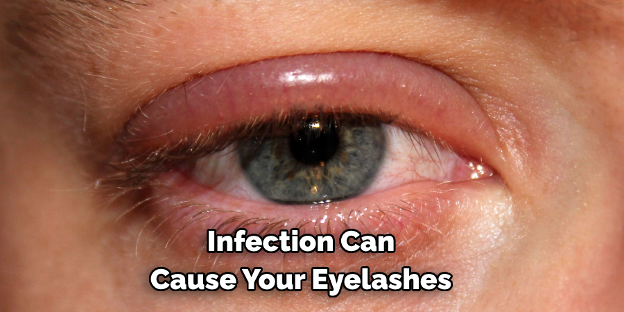 Infection Can 
Cause Your Eyelashes