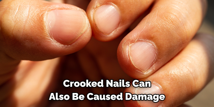 Crooked Nails Can
Also Be Caused Damage