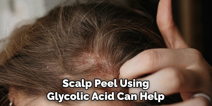 Scalp Peel Using Glycolic Acid Can Help
