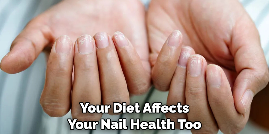 Your Diet Affects Your Nail Health Too