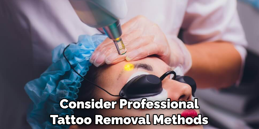 Consider Professional Tattoo Removal Methods