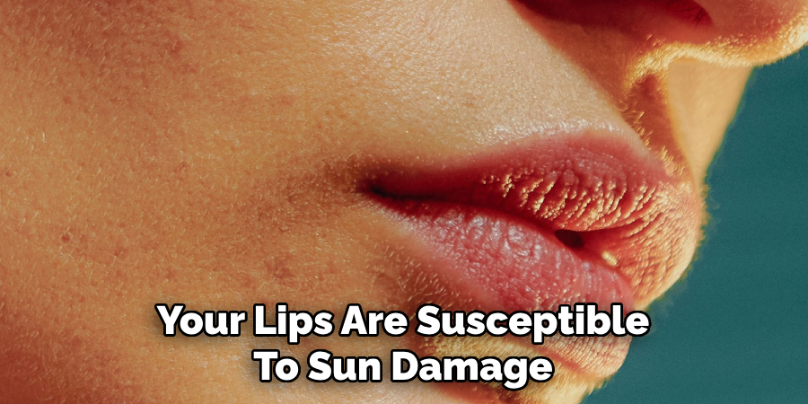 Your Lips Are Susceptible
To Sun Damage
