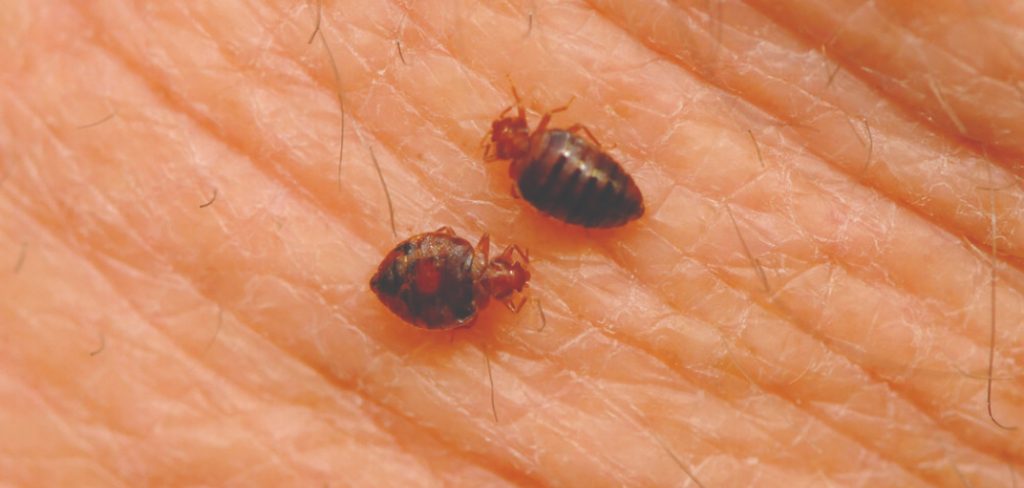 How to Get Bed Bugs Out of Your Hair