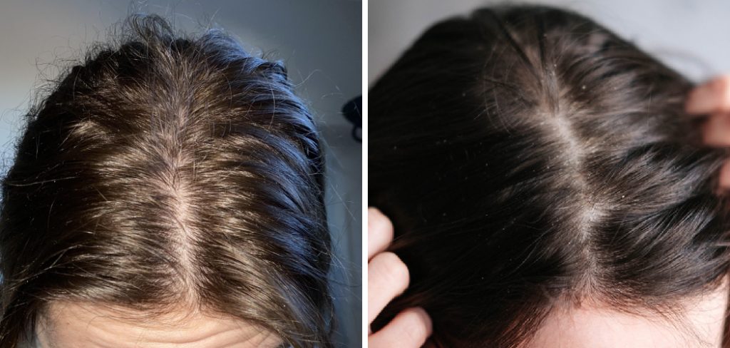 How to Tell if You Have Product Buildup in Hair