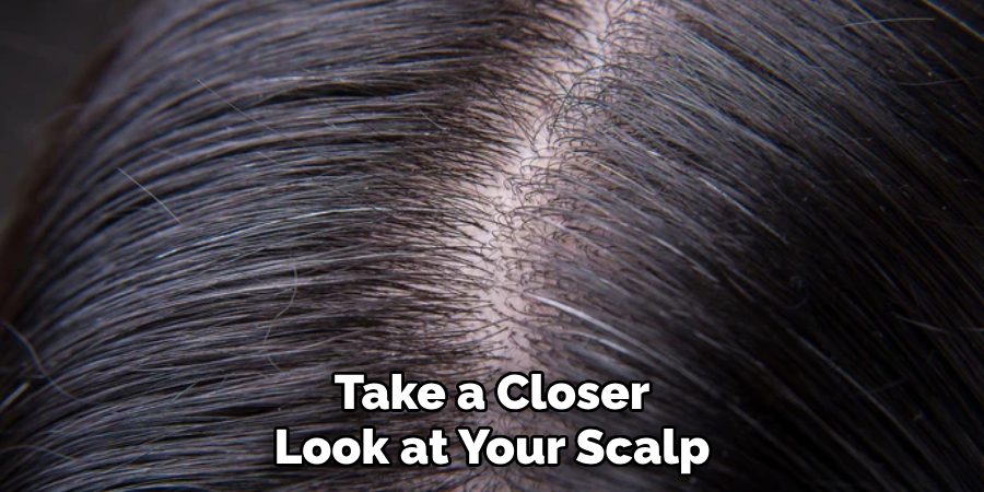 Take a Closer Look at Your Scalp