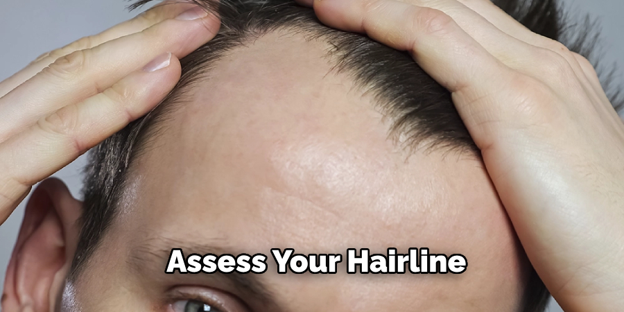 Assess Your Hairline