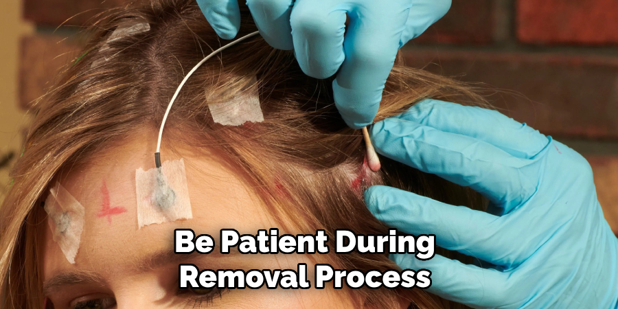 Be Patient During Removal Process