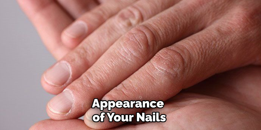 Appearance 
of Your Nails