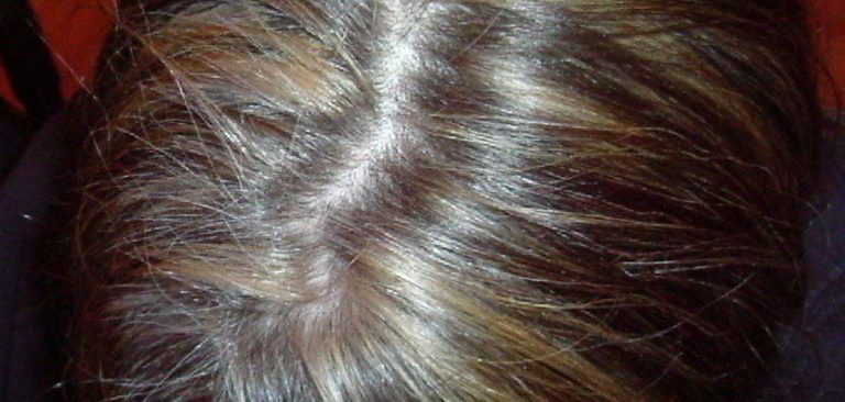 How to Hide Demarcation Line When Going Gray