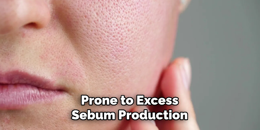 Prone to Excess
Sebum Production