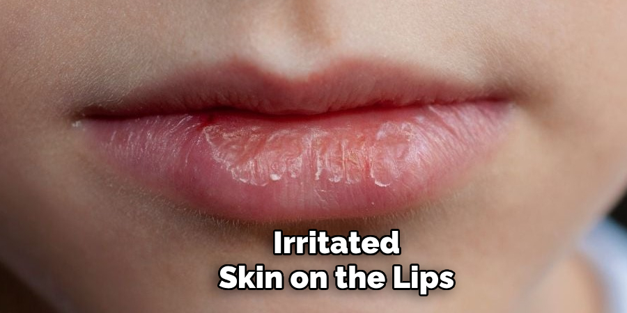 Irritated
Skin on the Lips