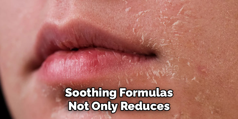 Soothing Formulas Not Only Reduces