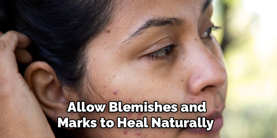 Allow Blemishes and
Marks to Heal Naturally