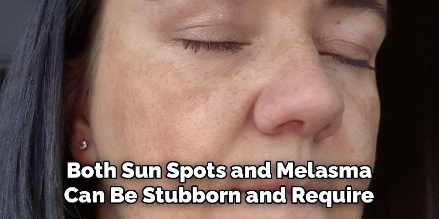 Both Sun Spots and Melasma Can Be Stubborn and Require