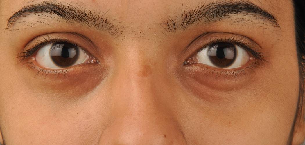 How to Cover Dark Circles