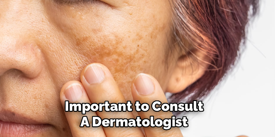 Important to Consult
A Dermatologist