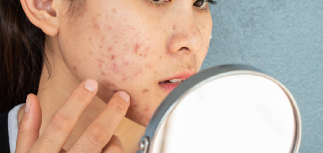 How to Hide Cuts with Makeup