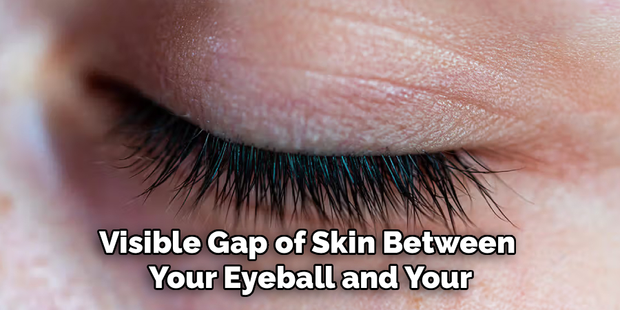 Visible Gap of Skin Between 
Your Eyeball and Your