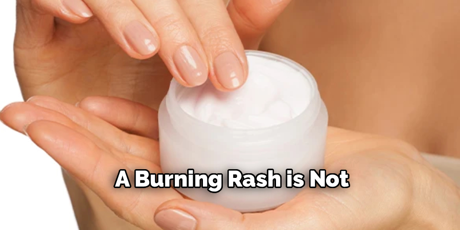 A Burning Rash is Not