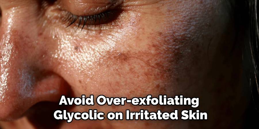 Avoid Over-exfoliating 
Glycolic on Irritated Skin