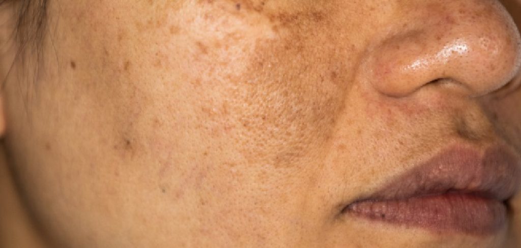 How to Use Premarin Cream on Face