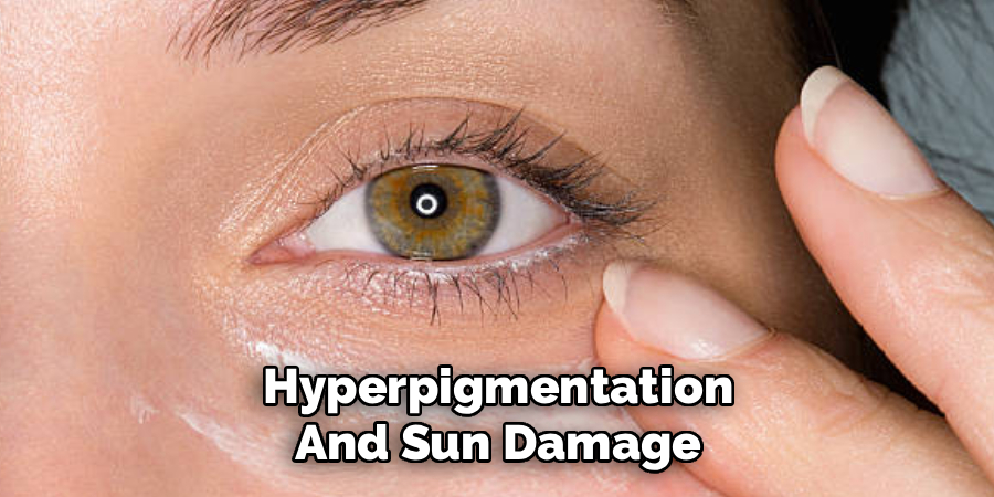 Hyperpigmentation
And Sun Damage