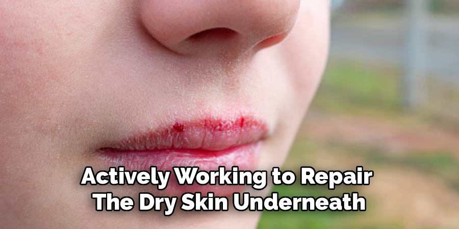 Actively Working to Repair 
The Dry Skin Underneath