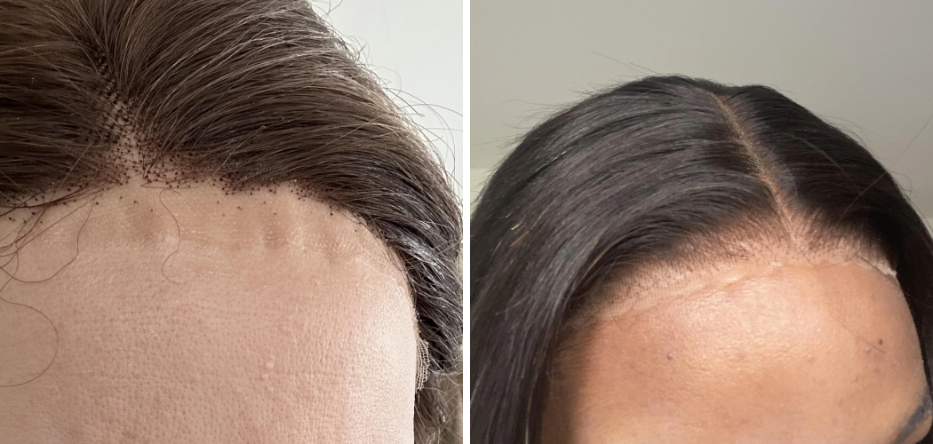 How To Make A Wig Not Itchy