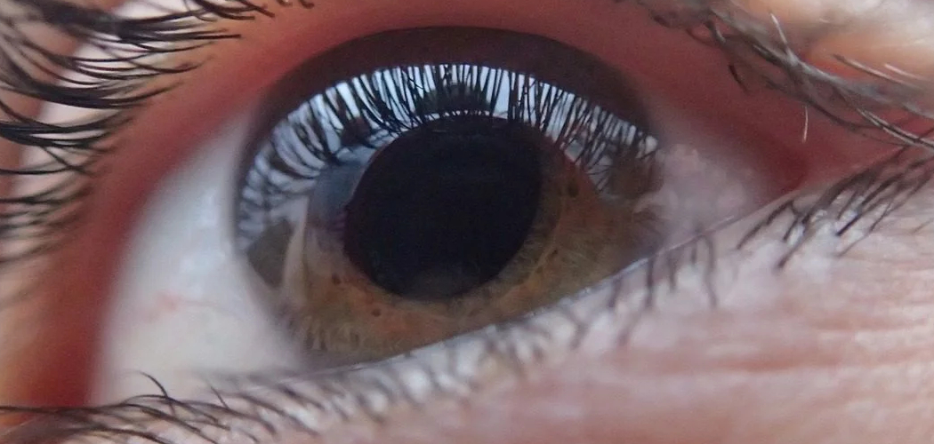 How to Relieve Itchy Eyes From Lash Extensions