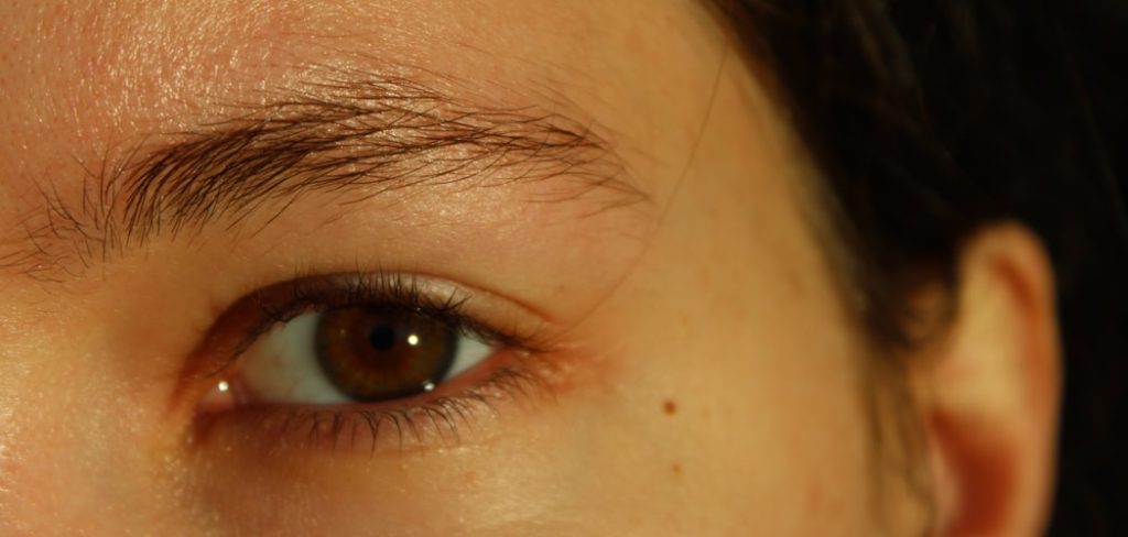 How to Treat Allergic Reaction to Lash Extensions