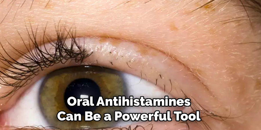 Oral Antihistamines 
Can Be a Powerful Tool 
