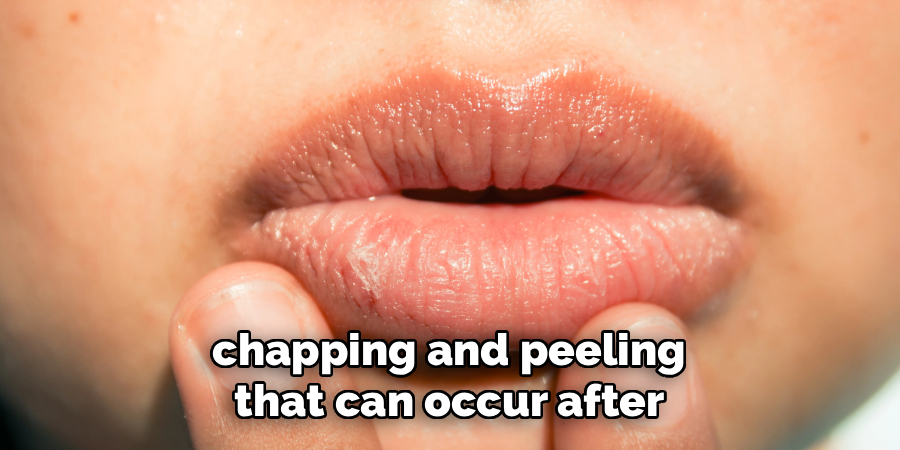 chapping and peeling 
that can occur after 
