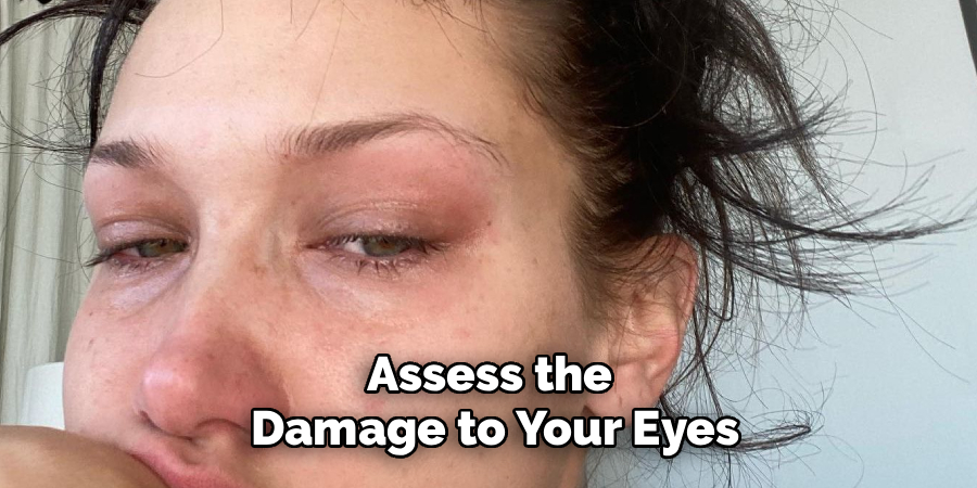 Assess the
 Damage to Your Eyes