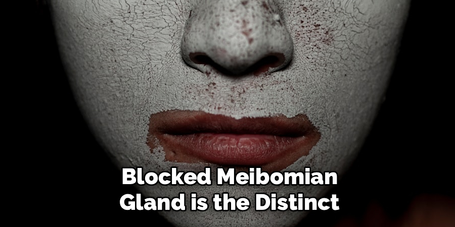 Blocked Meibomian Gland is the Distinct