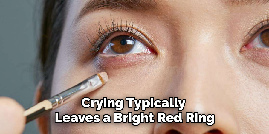 Crying Typically 
Leaves a Bright Red Ring