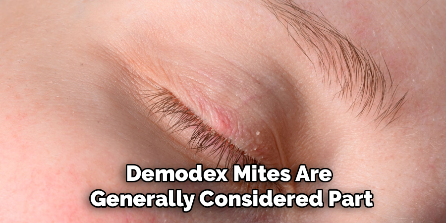 Demodex Mites Are
 Generally Considered Part