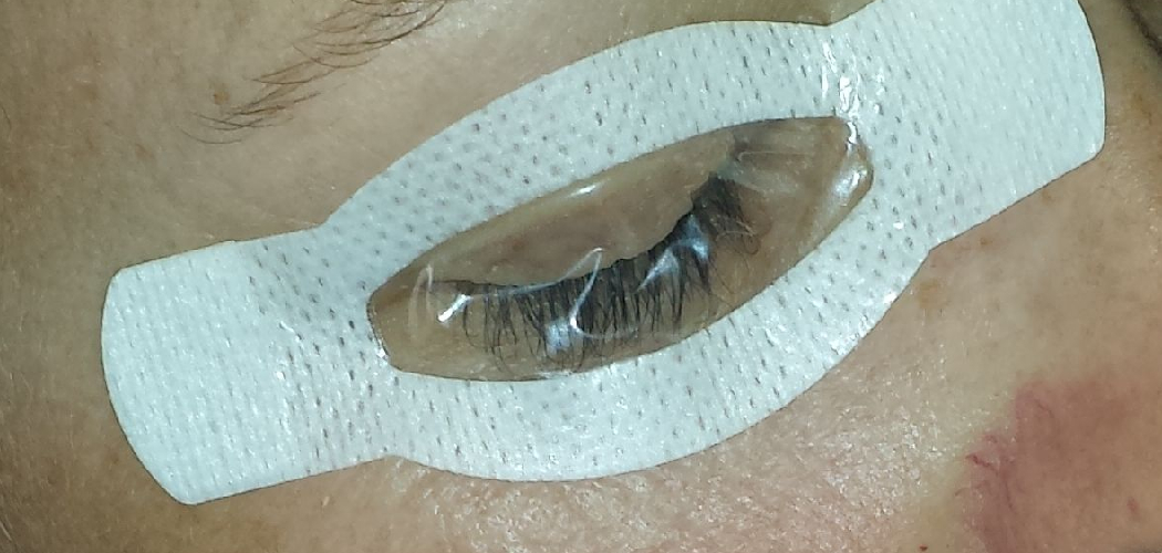How to Tape Eyelids Shut