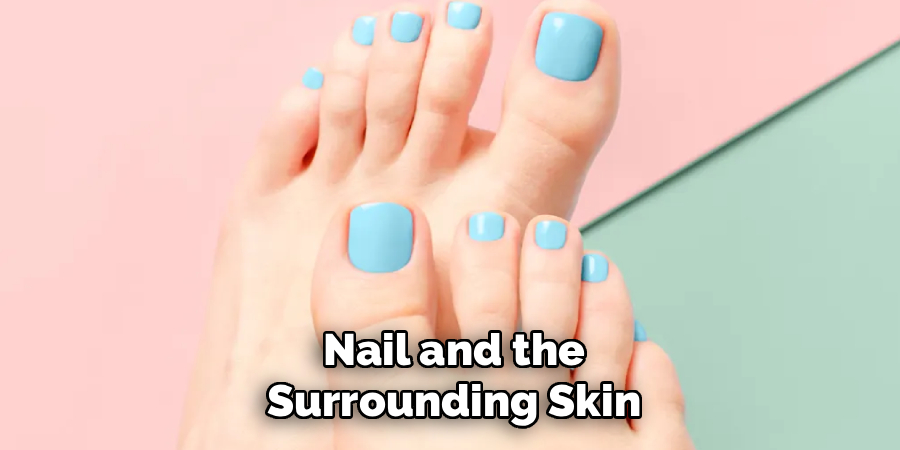 Nail and the Surrounding Skin