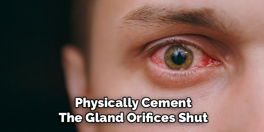 Physically Cement The Gland Orifices Shut